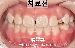수술전