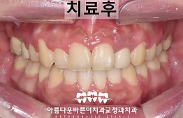 수술후