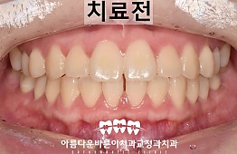 수술전