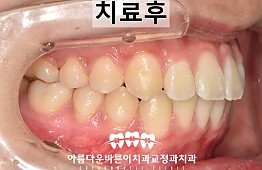 수술후