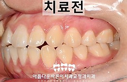 수술전