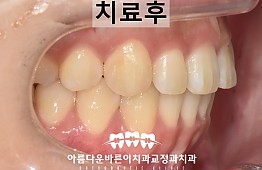 수술후