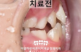 수술전