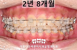 수술후