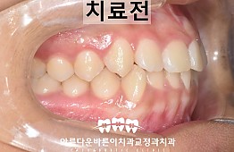 수술전