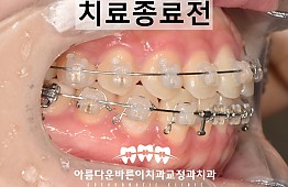 수술후