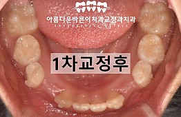 수술후