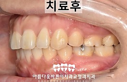수술후