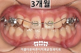 수술후