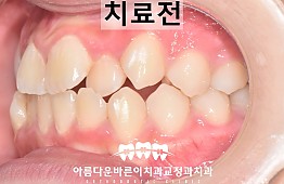 수술전