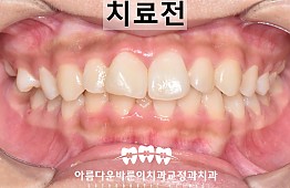 수술전