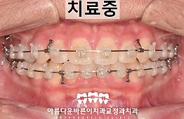 수술후