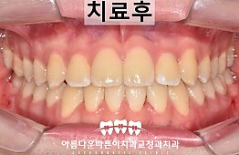 수술후