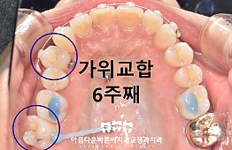 수술후