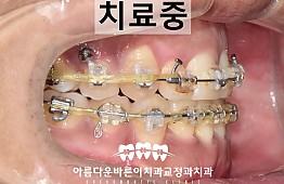 수술후