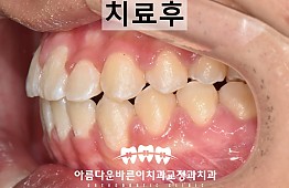 수술후