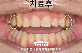 수술후