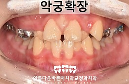 수술후