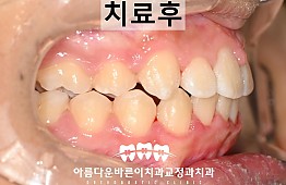수술후