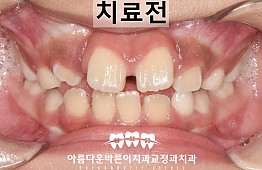 수술전