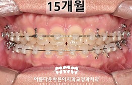 수술후