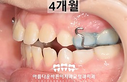 수술후