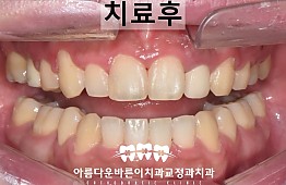 수술후