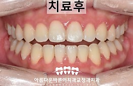 수술후