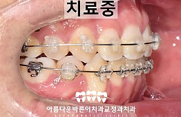 수술후