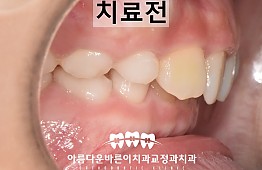 수술전