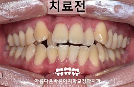 수술전