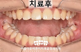 수술후