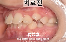 수술전