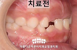 수술전