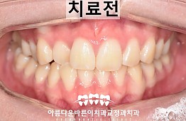 수술전