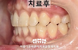 수술후