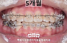 수술후