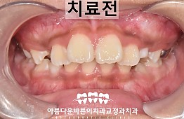 수술전