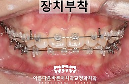 수술후