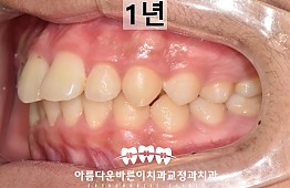수술후