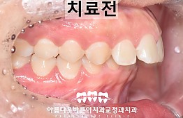 수술전
