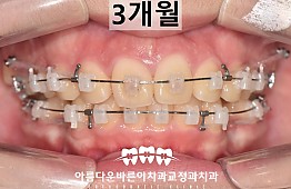 수술후