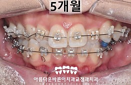 수술후
