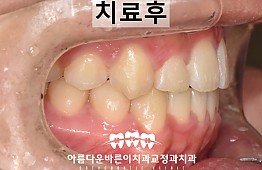 수술후