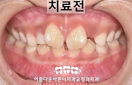 수술전