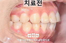 수술전