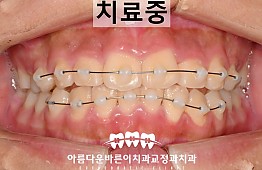 수술후