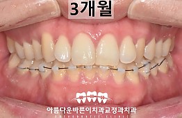 수술후
