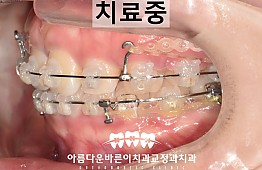수술후