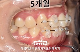 수술후